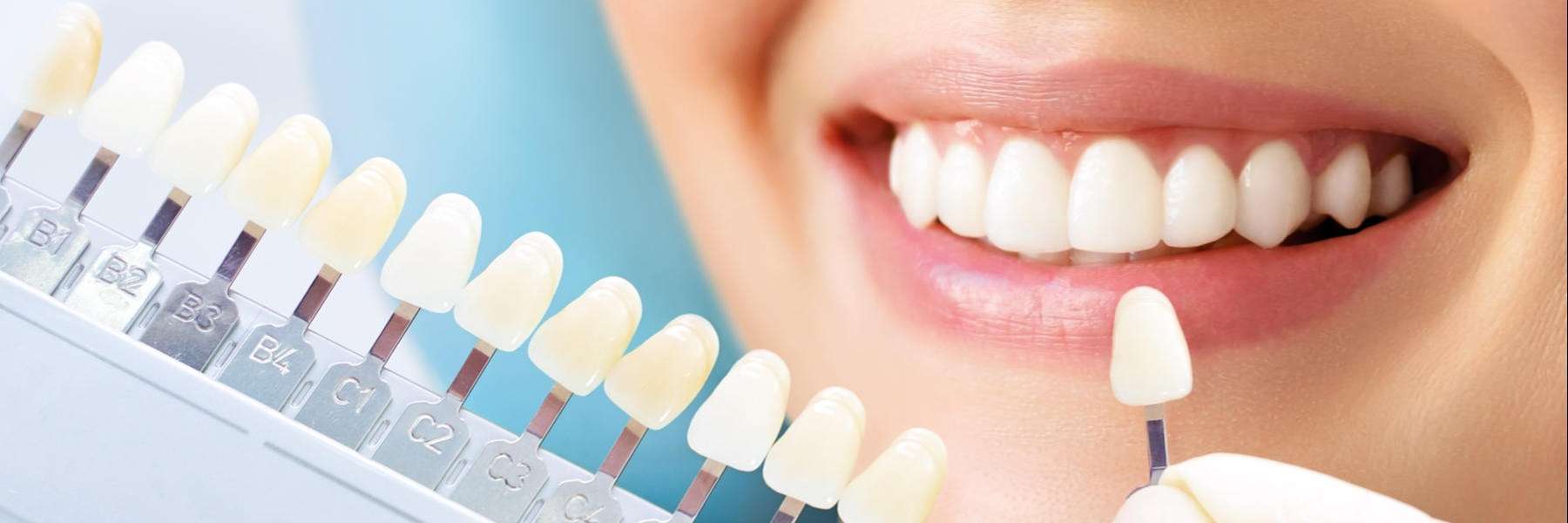 KöR Teeth Whitening | Dentist